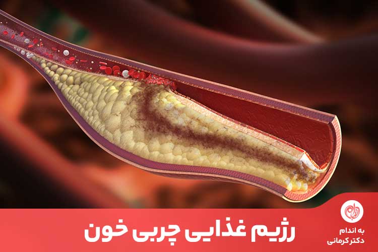 مقاله بالا‌بودن چربی خون به شدت برای سلامتی قلب انسان مضر می‌باشد