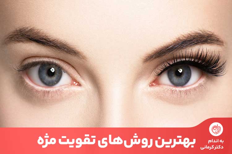 مقاله تقویت مژه به نوع تغذیه، آرایش کردن و میزان استرس فرد بستگی دارد.