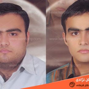 مقاله رکورددار کاهش وزن