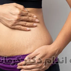 مقاله نشانه‌های دفع چربی از بدن