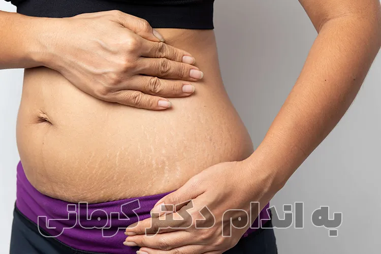 مقاله نشانه‌های دفع چربی از بدن