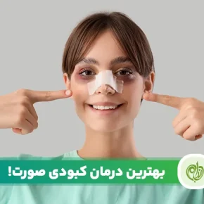 مقاله برای درمان کبودی صورت باید مجموعه ای از روش‌های غذایی و دارویی و..را درنظر بگیرید.